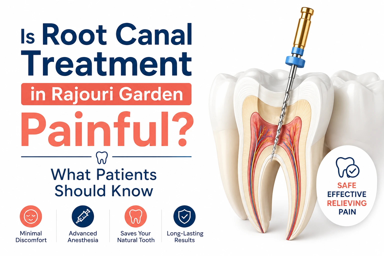 root-canal-treatment-in-Rajouri-Garden