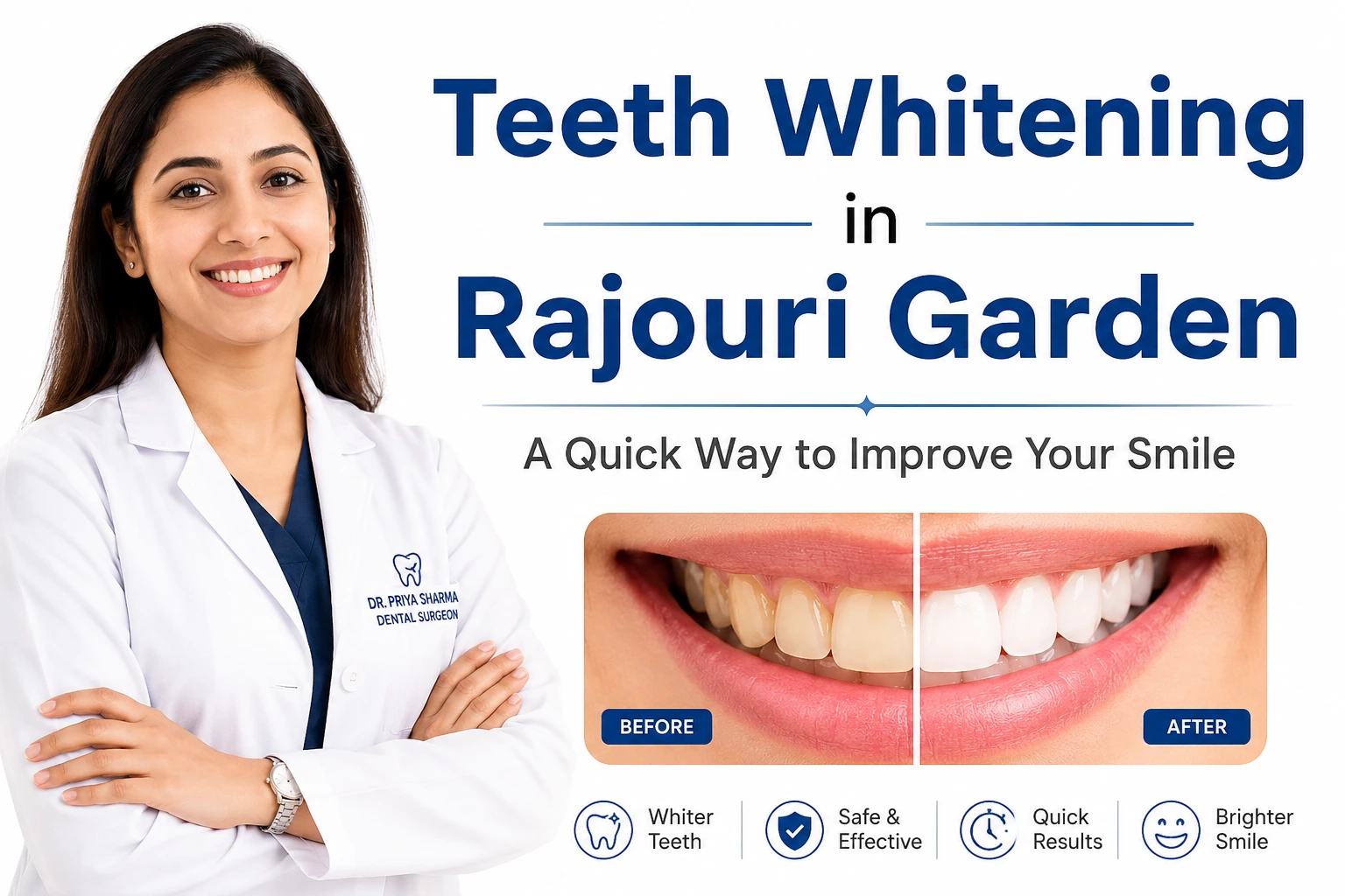 teeth-whitening-in-Rajouri-Garden